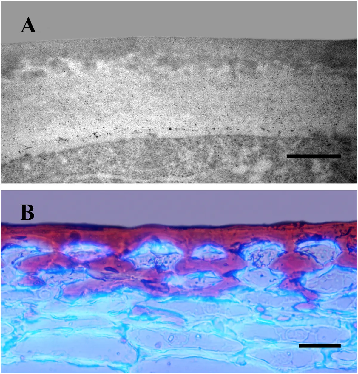 Coupe microscopique de l’épiderme d’une tomate montrant la cuticule au-dessus des cellules de la peau